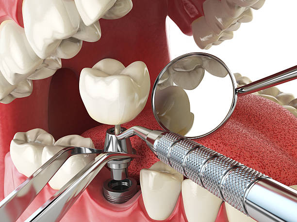 Best Knocked-Out Tooth Emergency  in Las Campanas, NM